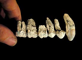 dent-australopitheque-white.jpg